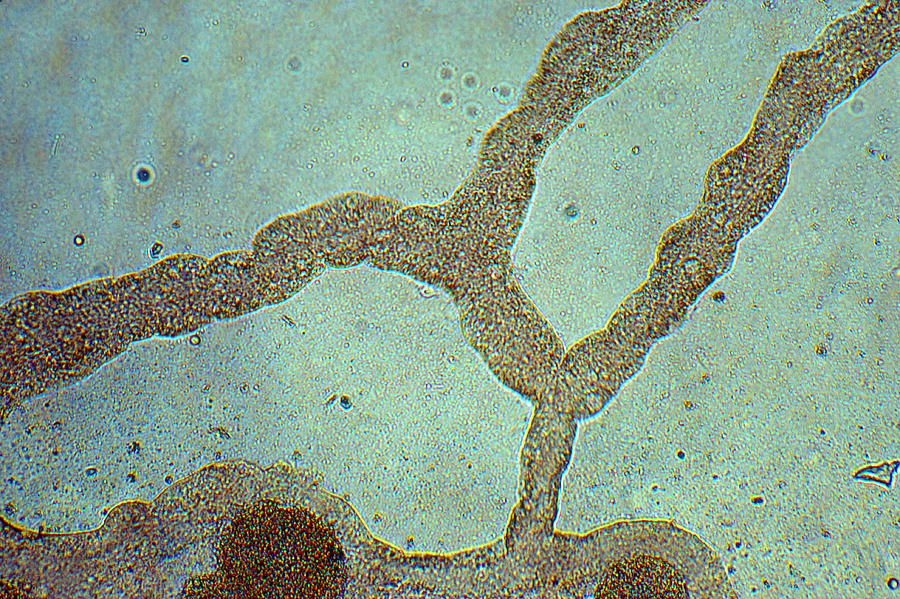 Didymium Plasmodium Photograph by Biology Pics