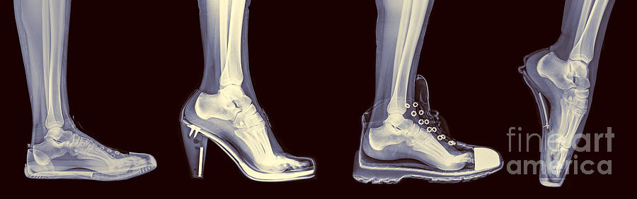 Different Shoes X-ray  Photograph by Guy Viner