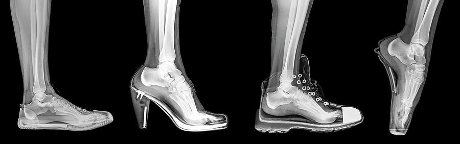 Different Shoes X-ray Photograph by Photostock-israel