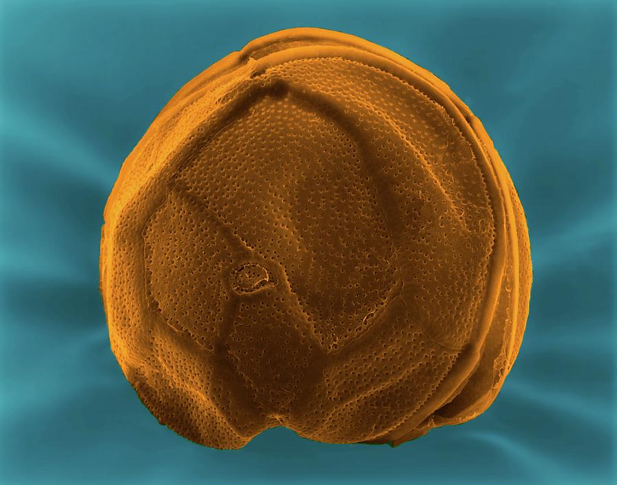 Dinoflagellate (gambierdiscus Toxicus) Photograph by Science Photo Library Dinoflagellate (gambierdiscus Toxicus) Photograph by Science Photo Library
