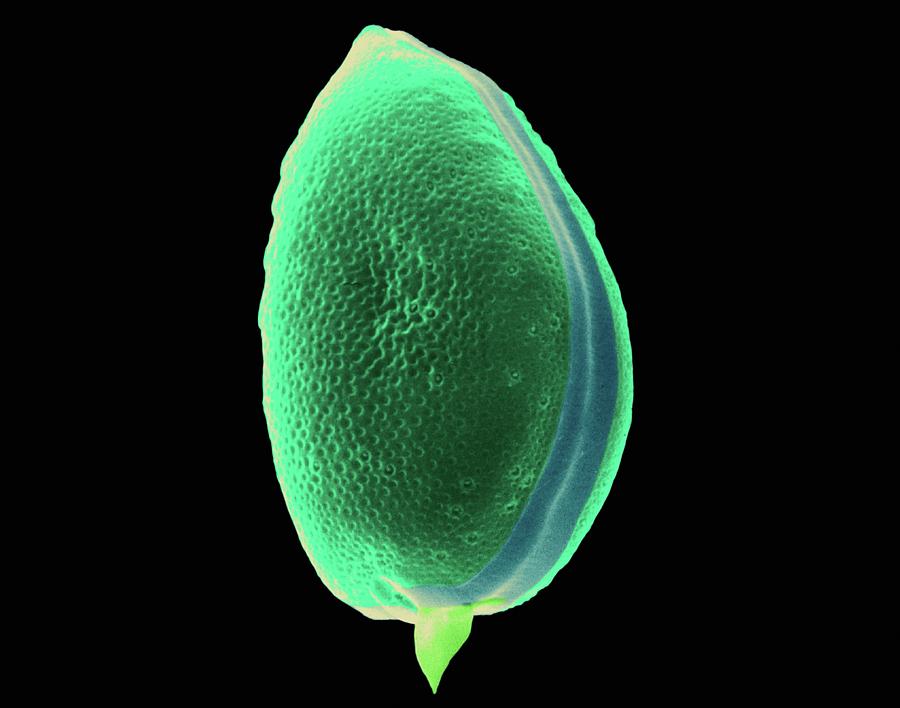 Dinoflagellate (prorocentrum Micans) Photograph by Science Photo Library Dinoflagellate (prorocentrum Micans) Photograph by Science Photo Library
