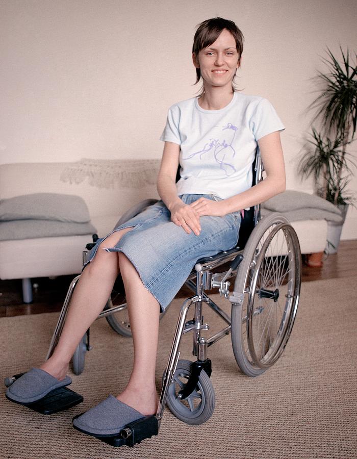 Disabled Woman Photograph by Lee Powers/science Photo Library