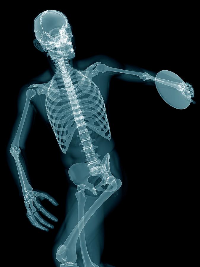 Athlete Photograph - Discus Throwers Skeletal System by Sebastian Kaulitzki/science Photo Library