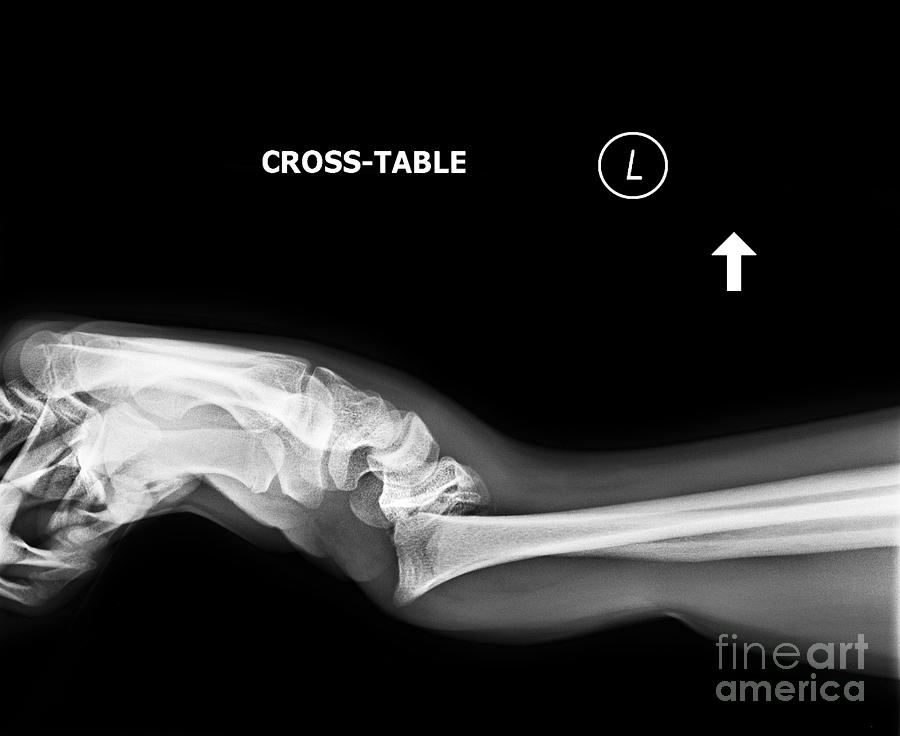 x ray wrist
