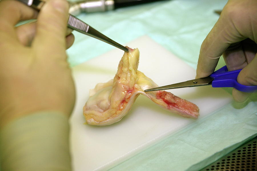Dissection Of Knee Tendon Photograph by Antonia Reeve/science Photo Library