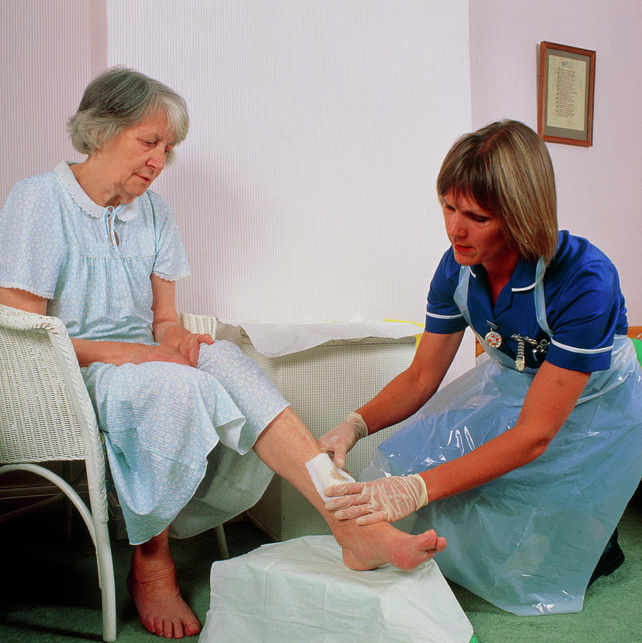 District Nurse Bandages Leg Ulcer On Old Woman Photograph by Chris Priest/science Photo Library