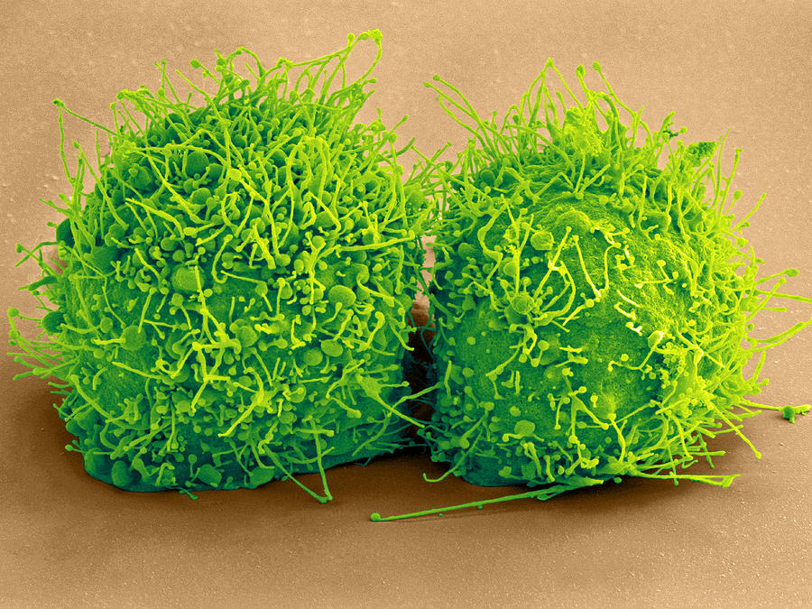 Dividing Hela Cells, Sem Photograph by Science Source