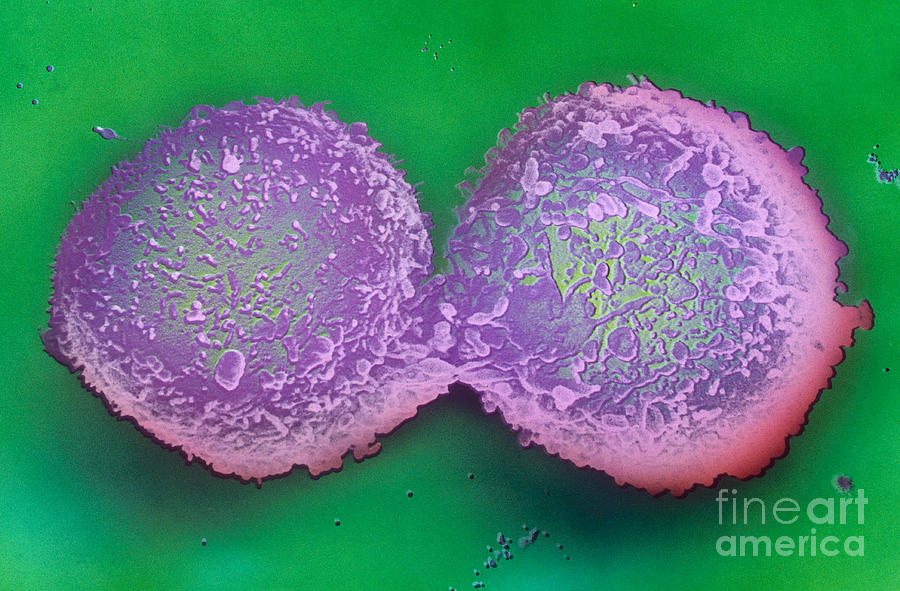 Dividing Lymphocyte Cells Photograph by David M. Phillips