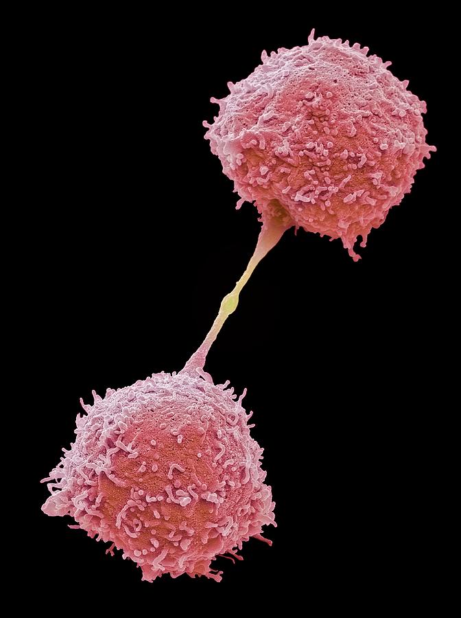 B-cell Photograph - Dividing Lymphocytes by Steve Gschmeissner