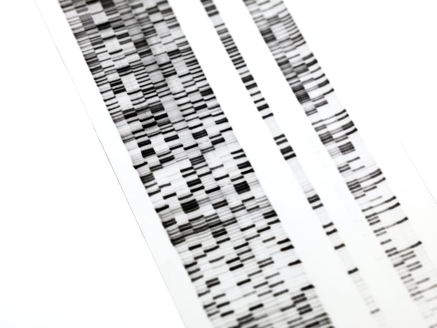 DNA autoradiogram Photograph by Tek Image/spl