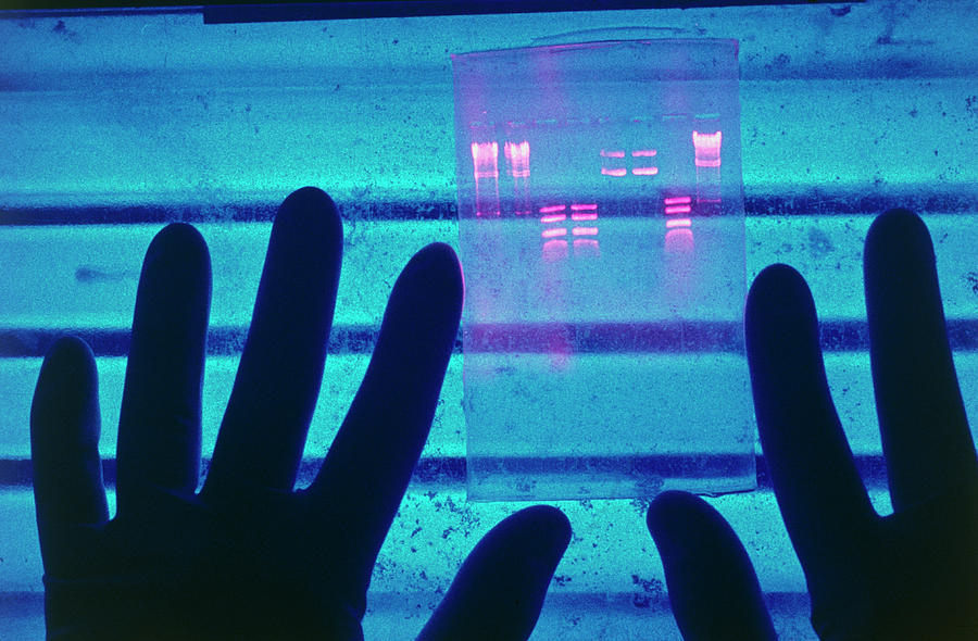 Dna Banding Pattern In Electrophoresis Gel Photograph by Peter Menzel/science Photo Library