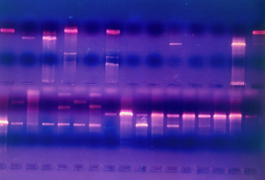 Dna Fragments In Gel Stained With Ethidium Bromide Photograph by Klaus Guldbrandsen/science Photo Library