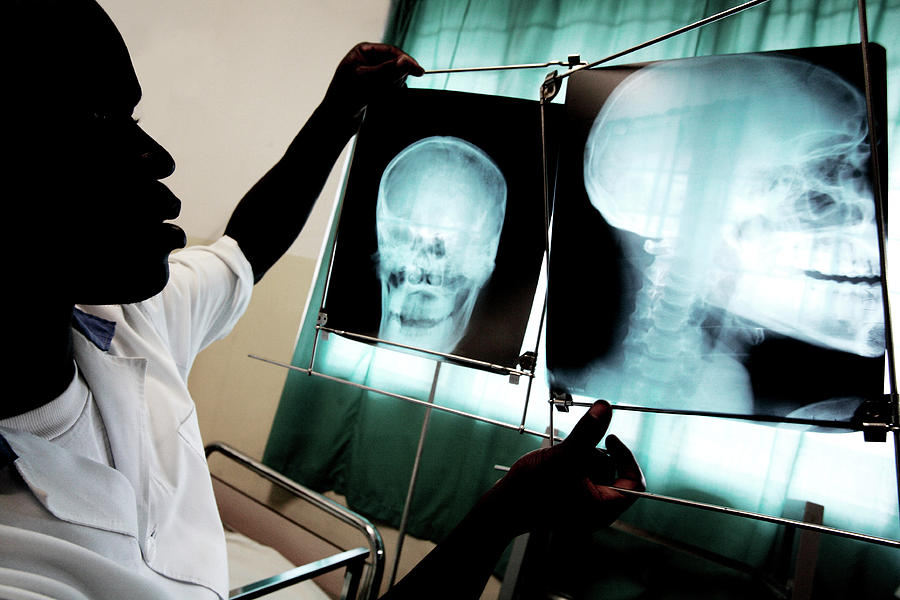 Doctor Looking At X-rays Photograph by Mauro Fermariello/science Photo Library