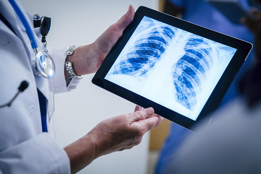 Doctors examining x-ray of chest and ribs on digital tablet Photograph by FS Productions