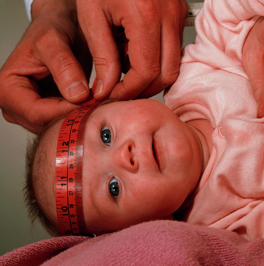 Doctor's Hands Measuring With Tape A Baby's Head by Saturn Stills