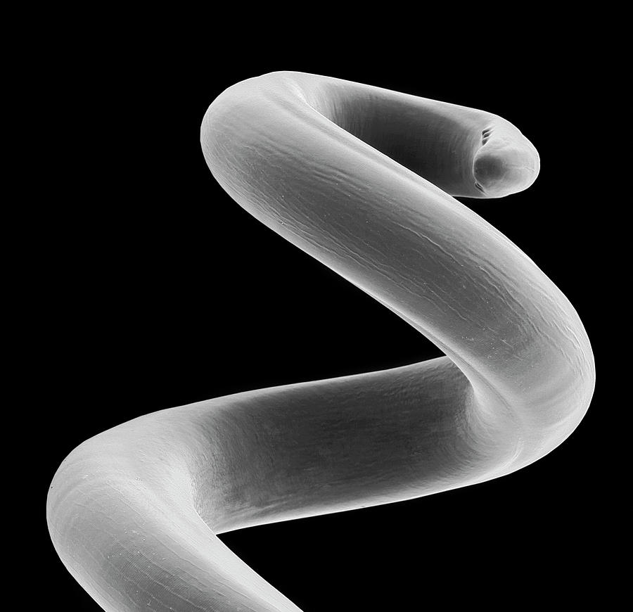 Dog Lungworm Photograph by Dennis Kunkel Microscopy/science Photo Library