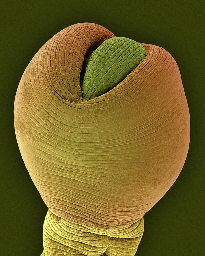 Animal Photograph - Dog Tapeworm Cysticeroid Stage by Dennis Kunkel Microscopy/science Photo Library