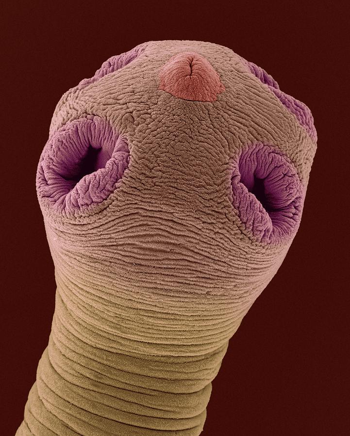 Dog Tapeworm Scolex (dipylidium Caninum) Photograph by Dennis Kunkel ...