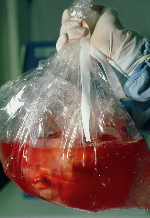 Donated Human Heart Packaged For Transpla Photograph by Klaus Guldbrandsen/science Photo Library