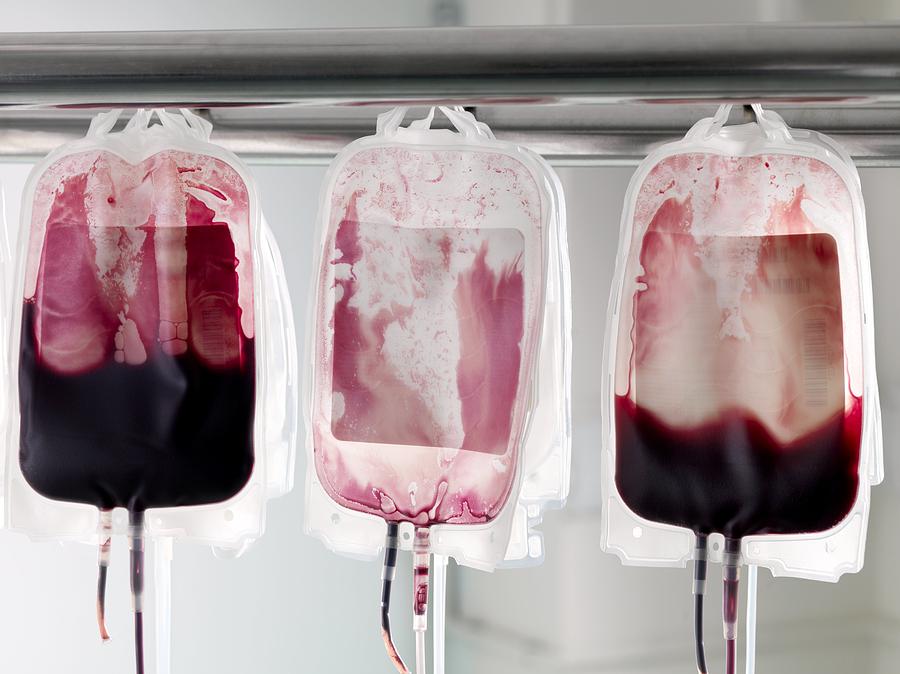 Donor blood in blood bags being separated into its component parts Photograph by Science Photo Library - TEK IMAGE.