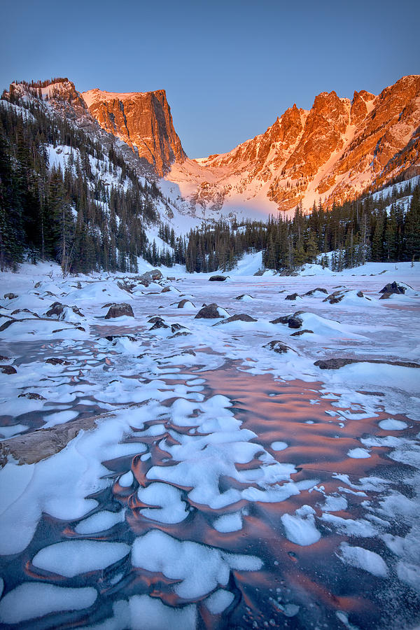 Dream Lake - Rocky Mountain National Park Photograph by Ronda Kimbrow