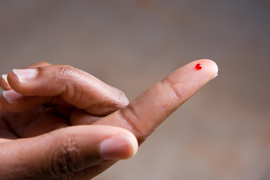 Drop of blood on fingertip for a medical exam Photograph by MarkHatfield