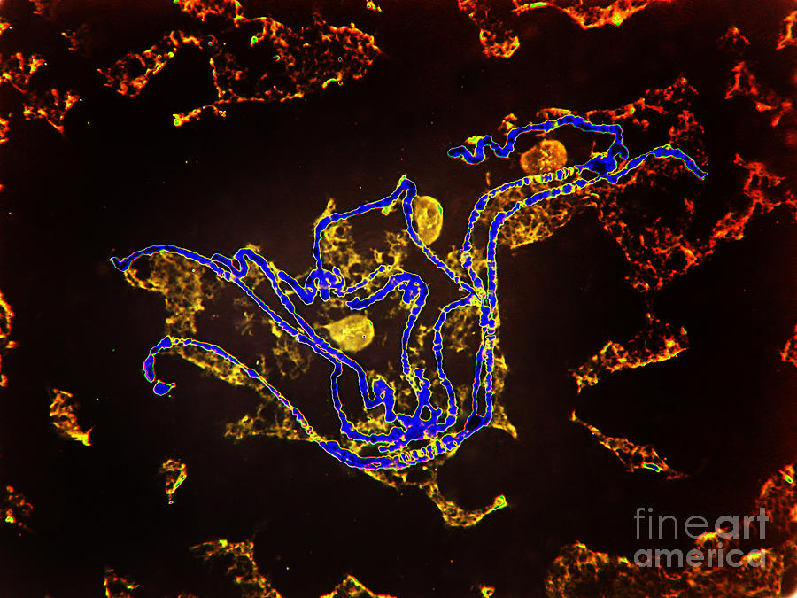 Drosophila Chromosome Photograph by Garry DeLong