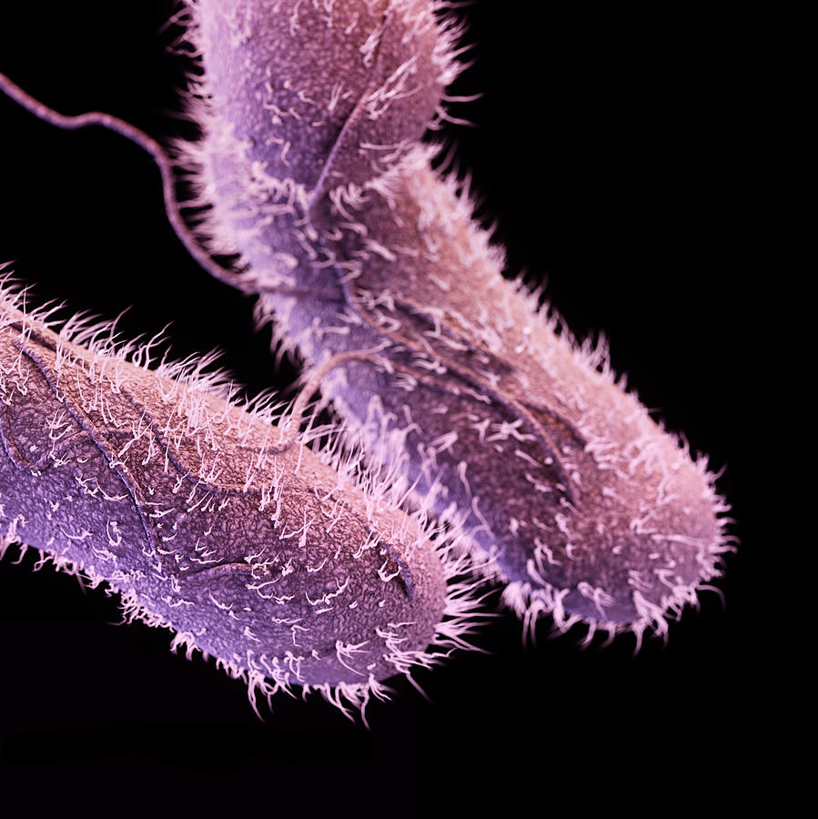 Foodborne Illness Photograph - Drug-resistant Non-typhoidal Salmonella by S...