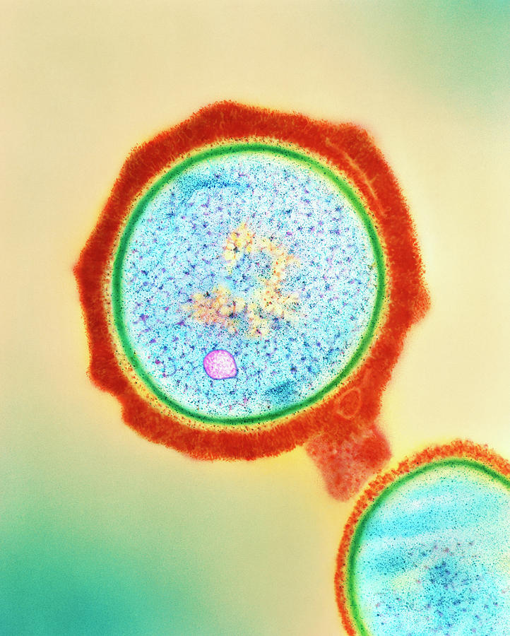 Drug Resistant Staphylococcus Bacteria Photograph by Dr Kari Lounatmaa/science Photo Library