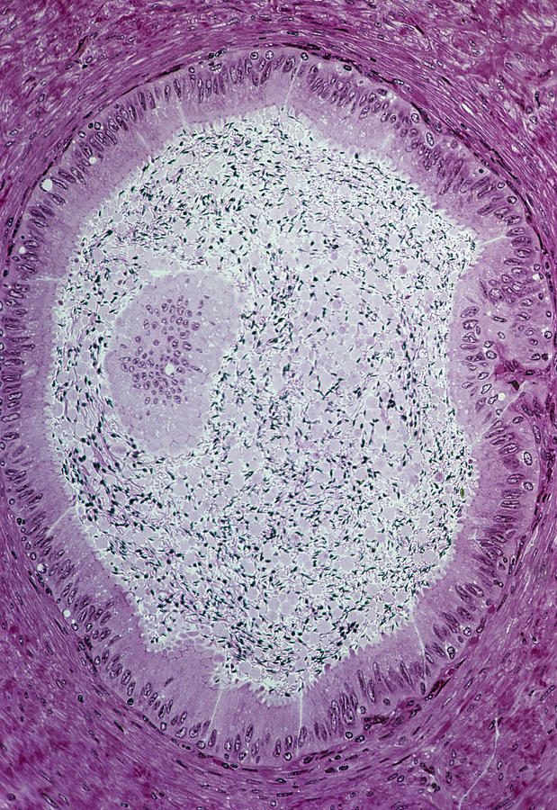 DUCTUS DEFERENS (or VAS DEFERENS). Cross section, 50X at 35mm. Shows: the ductus deferens lined with pseudostratified ciliated columnar, epithelium, spermatozoa in the lumen, and smooth muscle in the wall. Photograph by Ed Reschke
