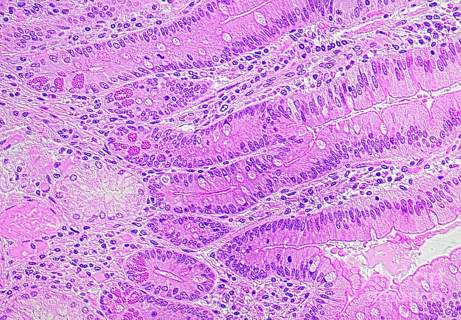 Duodenum Photograph - Duodenum Wall, Ts For Paneth Cells by M. I. Walker