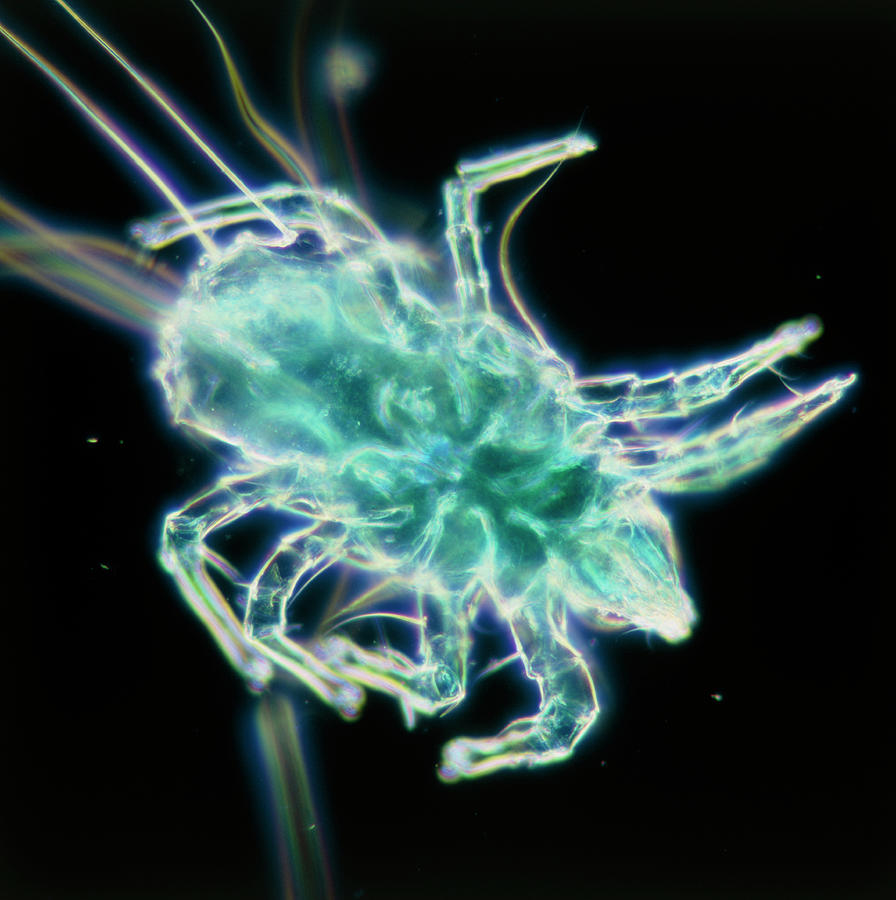 Dust Mite Photograph by Alfred Pasieka/science Photo Library