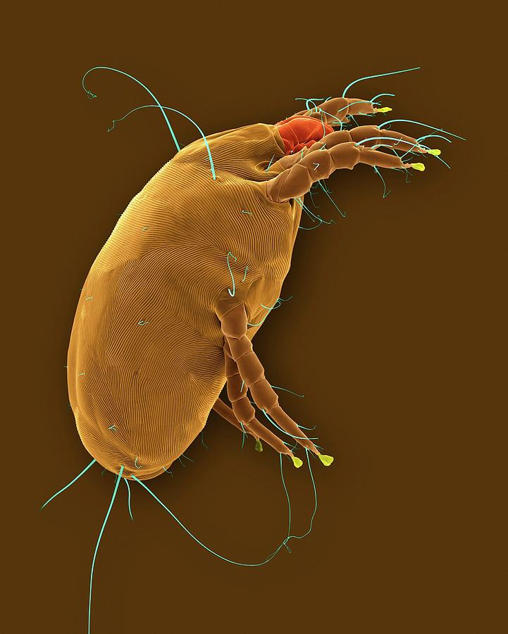 Dust Mite (dermatophagoides Pteronyssinus) by Dennis Kunkel Microscopy ...