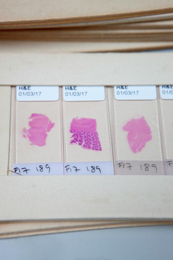 Dyed Brain And Tissue Specimens Photograph by Lewis Houghton/science Photo Library
