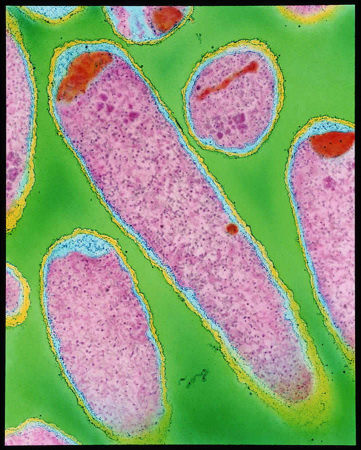 E Coli 0157 H7 Bacteria Photograph By Dr Kari Lounatmaa Science Photo