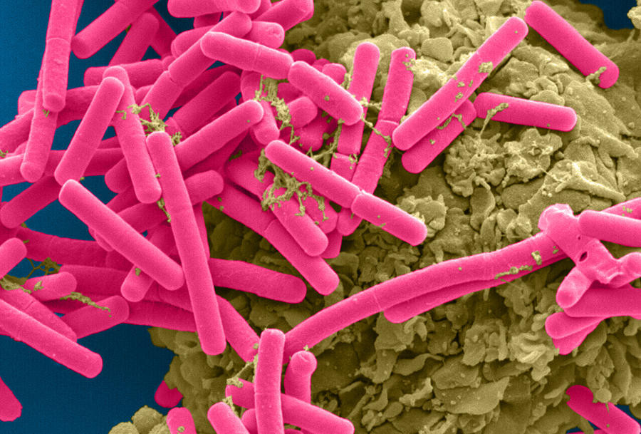 E. Coli And Macrophage Sem Photograph by Science Source