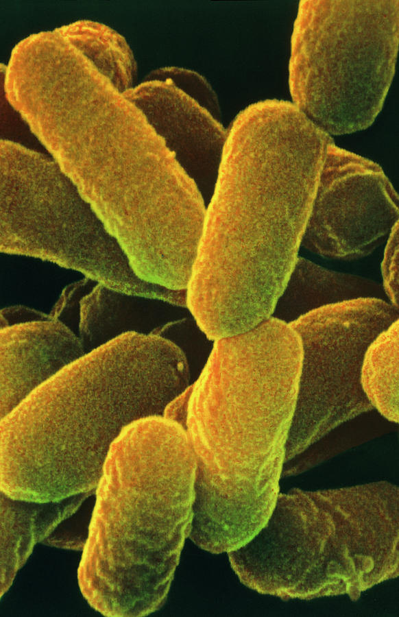 E Coli Bacteria Photograph By Dr Kari Lounatmaa Science Photo Library