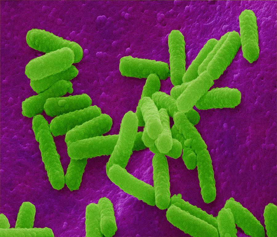Escherichia Photograph - E. Coli Bacteria by Power And Syred