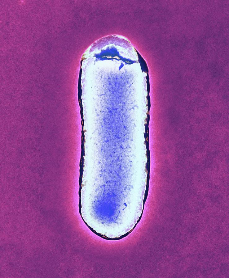 Escherichia Coli Photograph - E. Coli Bacterium by Centre For Infections/public Health England/science Photo Library