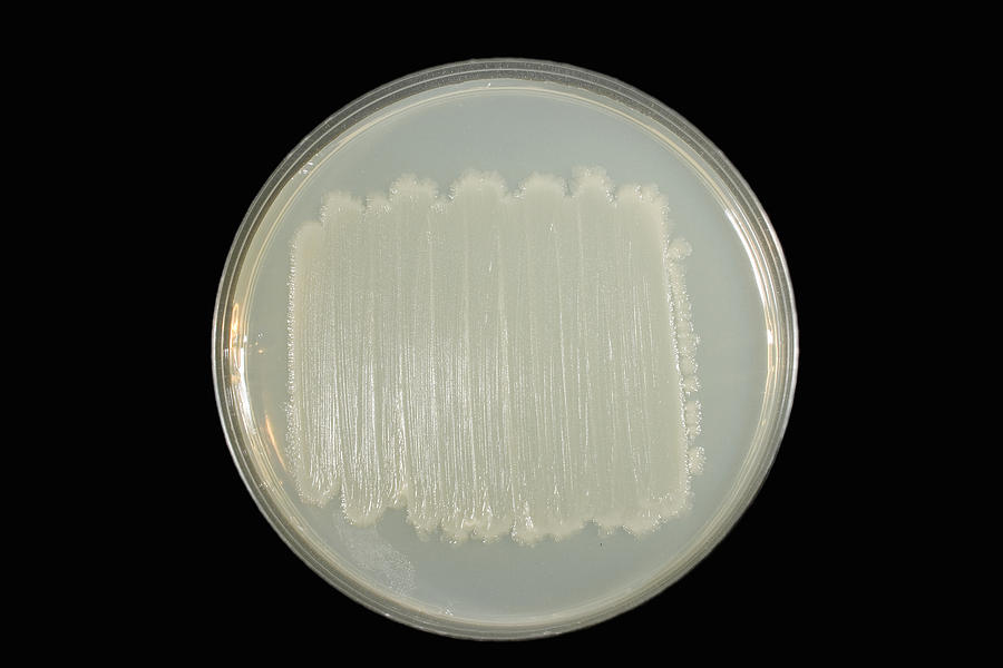 E. Coli Culture Photograph by Science Stock Photography