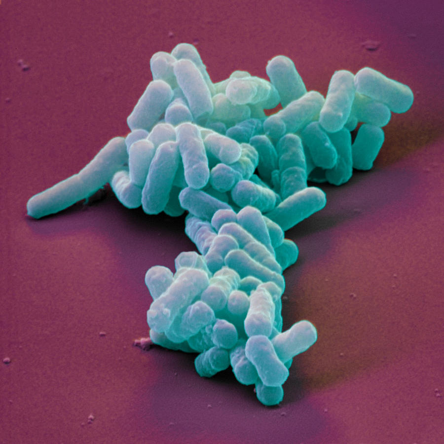 E. Coli Entero-haemorrhage Bacteria Photograph by Eye of Science