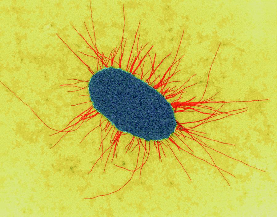 E. Coli With Fimbriae Photograph by Dennis Kunkel Microscopy/science Photo Library