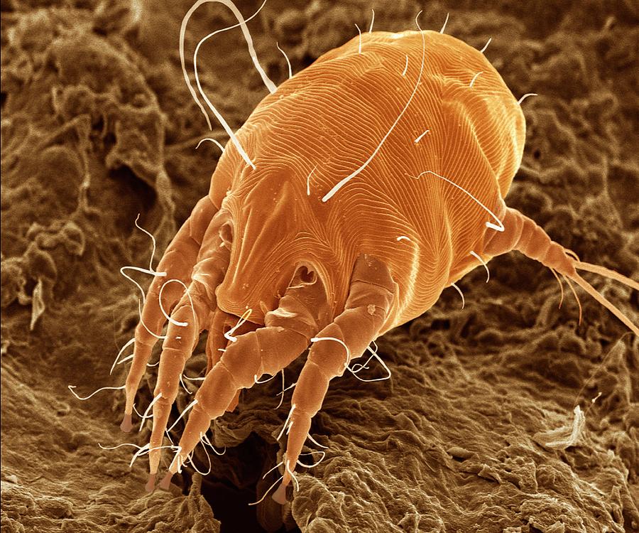 Ear Mite Otodectes Cynotis Photograph By Power And Syred Pixels