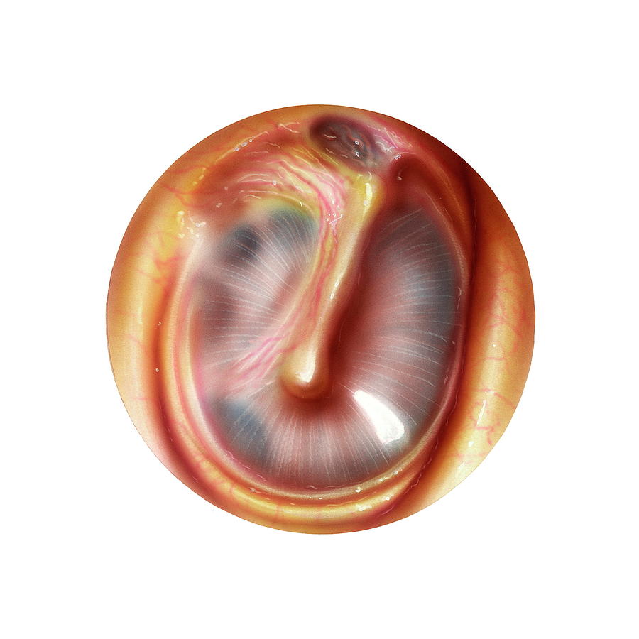 Eardrum Photograph by Bo Veisland/science Photo Library