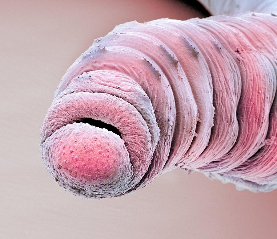 Earthworm head, SEM by Science Photo Library