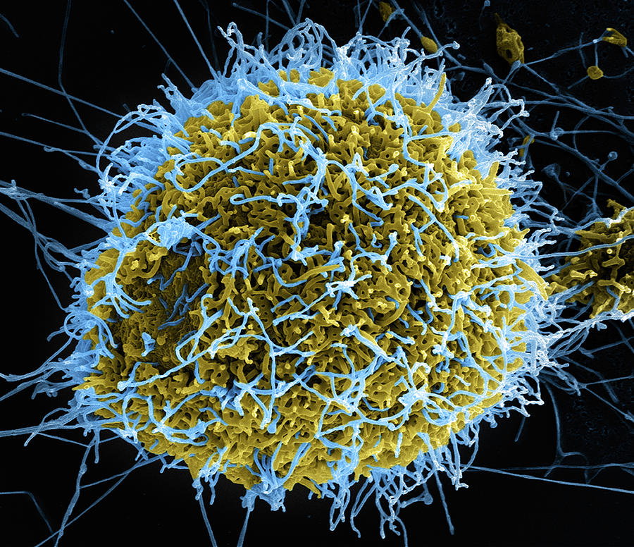 Ebola Photograph - Ebola Virus Budding From Cell by National Institutes Of Health