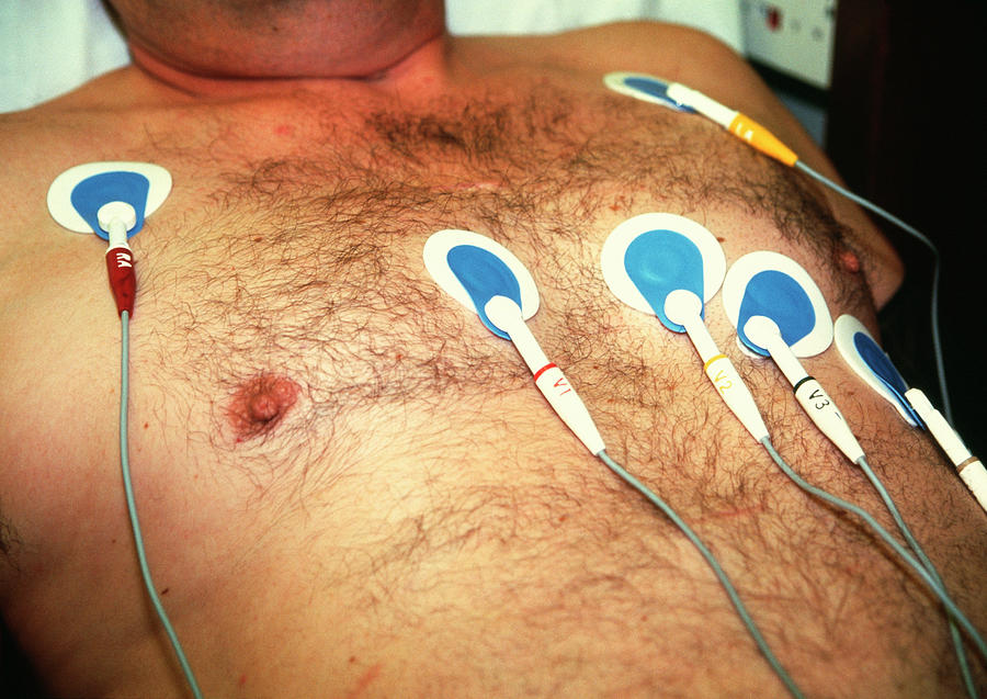 Electrode Photograph - Ecg Electrodes by Antonia Reeve/science Photo Library