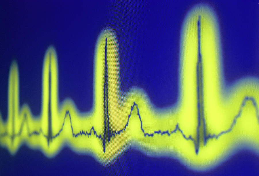 Ecg Of A Normal Heart Rate Photograph by Daniel Sambraus/science Photo Library
