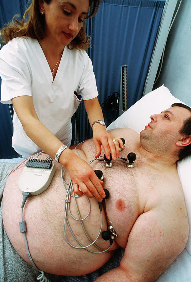 Ecg On Obese Man Photograph by Mauro Fermariello/science Photo Library