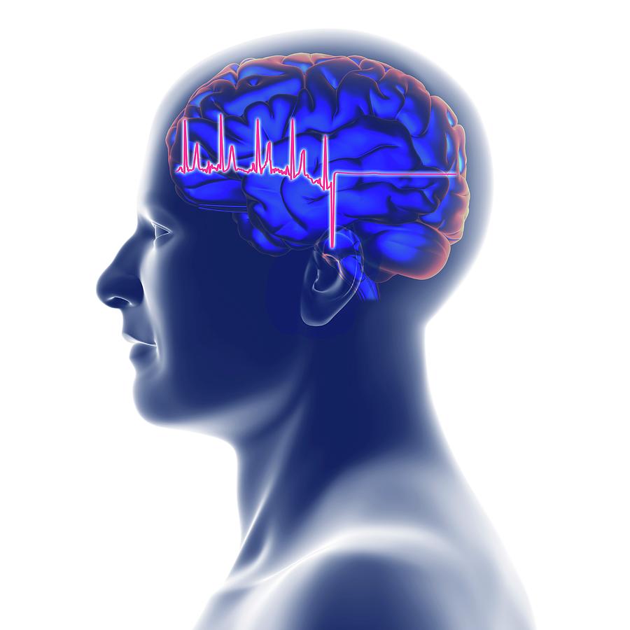 Ecg Trace And Head With Brain Photograph by Alfred Pasieka/science